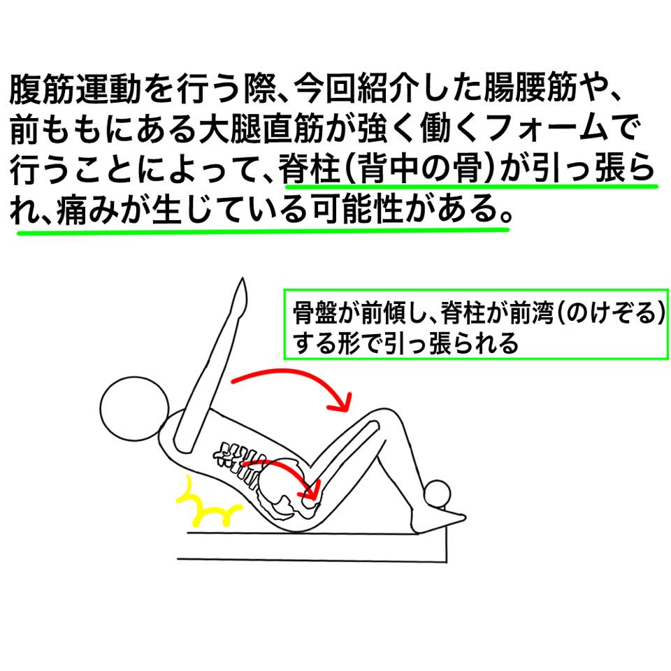腹筋で腰が痛い方向けイラスト解説 Key Fit 腹筋で腰が痛い方向けイラスト解説 Key Fit
